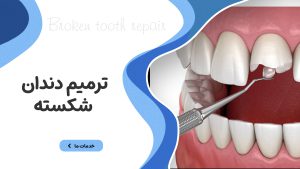 ترمیم دندان شکسته
