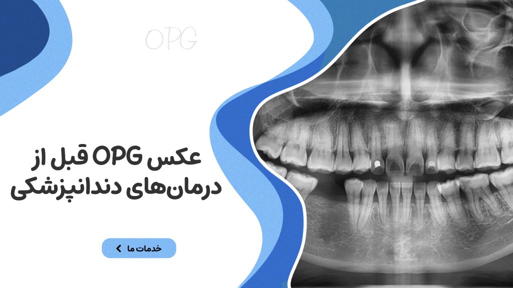عکس OPG قبل از درمان‌های دندانپزشکی